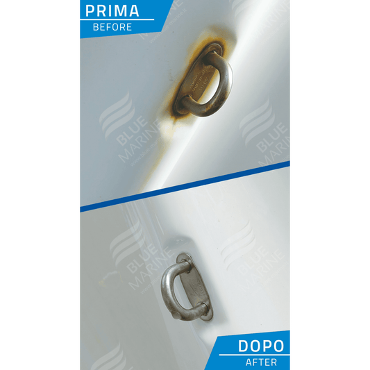 Laser Gel - saurer Entkalker